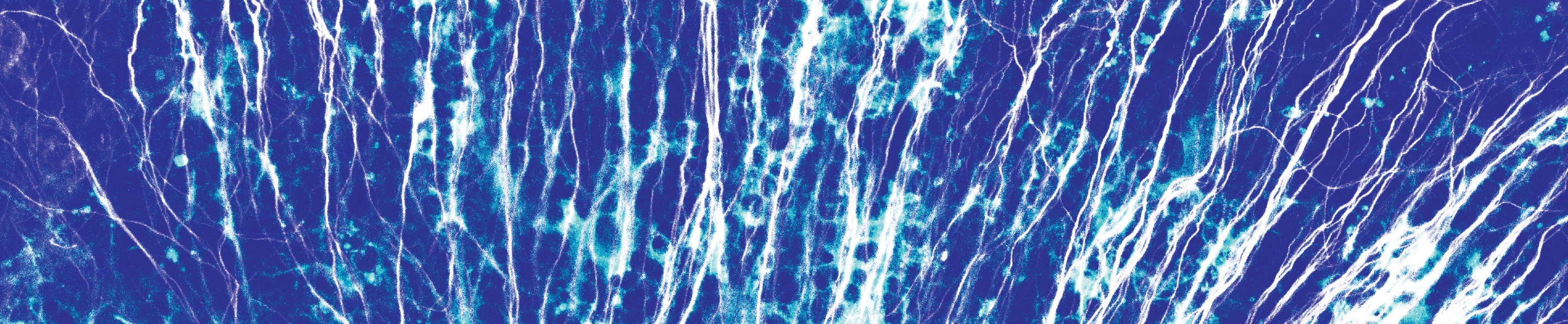 Close-up of a microscope slide, resembling lighting streaks